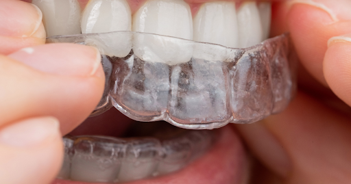 10 Surprising Benefits of Braces and Aligners  Say Goodbye to Crooked Teeth